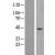 Western Blot: ABHD3 Lysate [NBL1-07197] - Western Blot experiments. 
Left-Control; Right -Over-expression Lysate for ABHD3